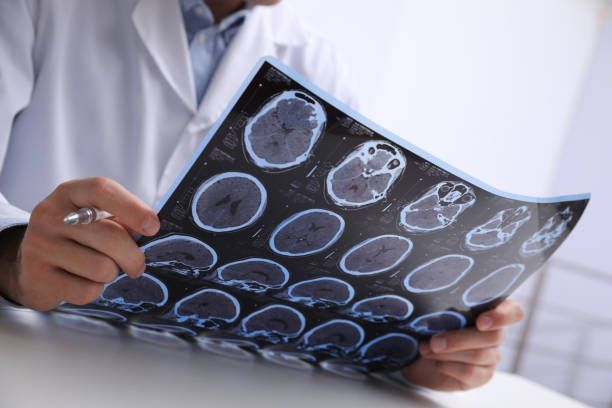 Hirntumor