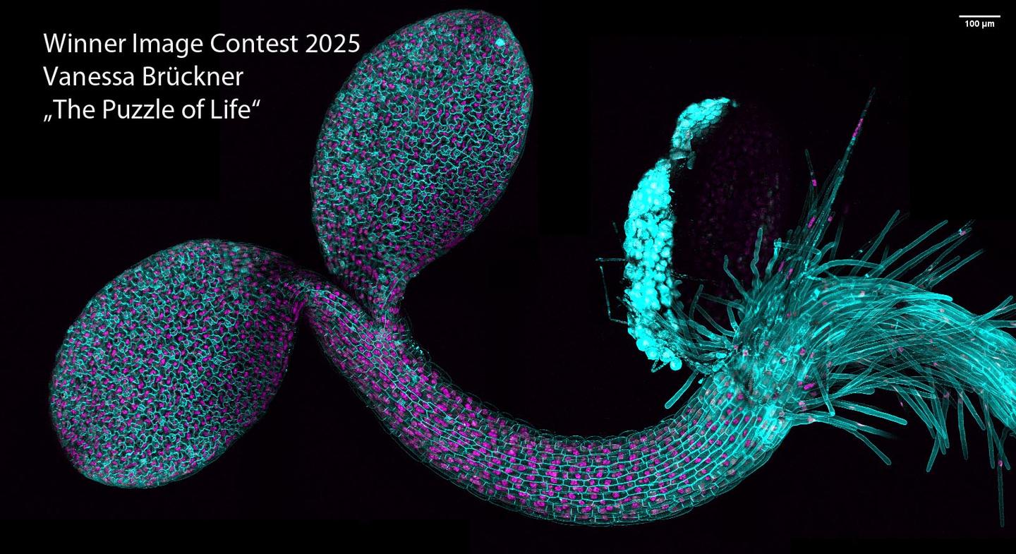 "The Puzzle of Life" Winner Image Contest 2025