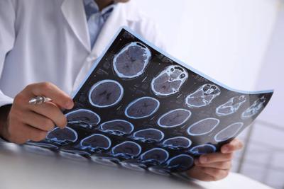 Hirntumor